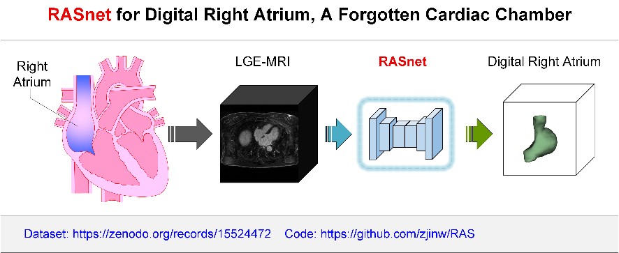 人工智能助力右心房的数字化。研究团队供图,下同