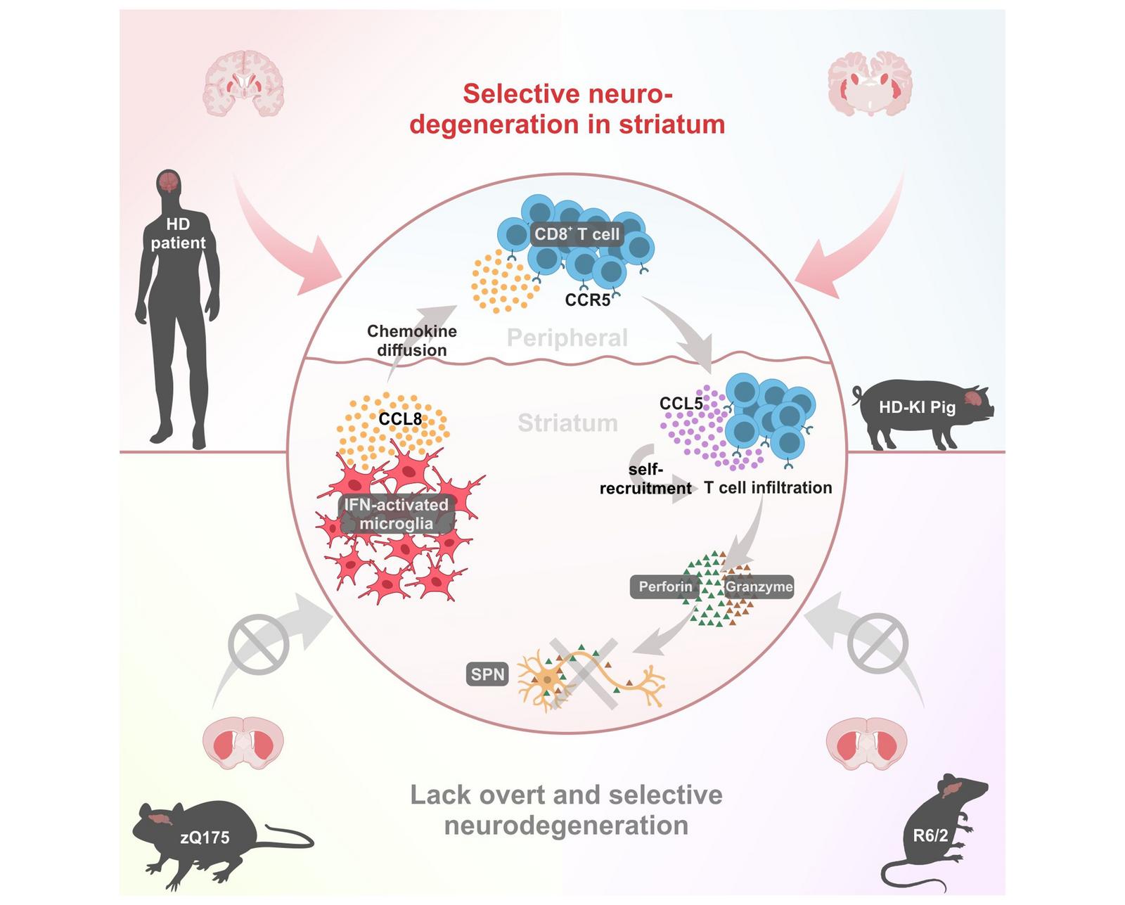 CD8+T细胞驱动HD神经退行性变的示意图